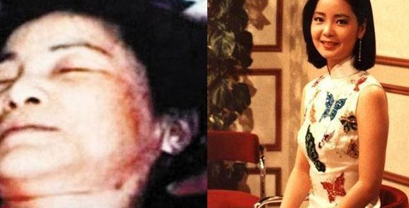 邓丽君死原因真相(邓丽君到底是病死的还是她法国男友打掐脖子 死的？你们推断一下？)
