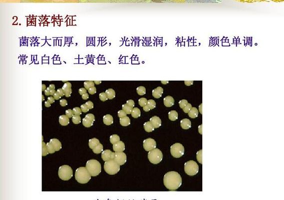 酵母菌是真菌吗（白假丝酵母菌是真菌吗）