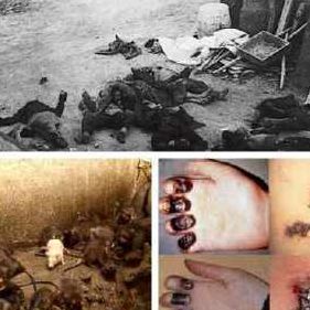 黑死病是什么病（黑死病是什么病能治么）