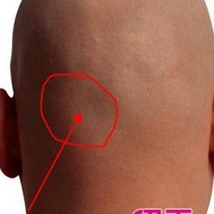 后脑勺疼是怎么回事(后脑勺疼是什么原因？)
