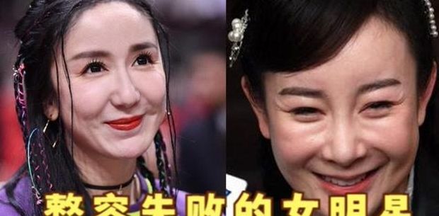 明星整形失败（明星整容失败前后对照的图片）