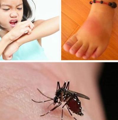 蚊子更喜欢叮咬（蚊子更喜欢叮咬运动出汗的人吗）