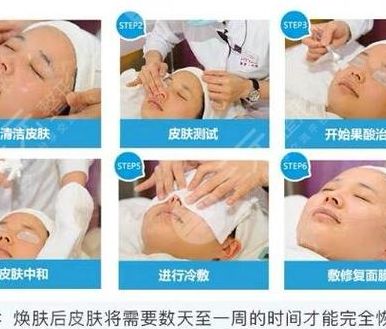 果酸美容（果酸美容院可以做吗）