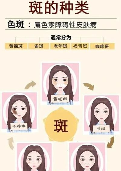 祛斑知识（祛斑知识怎么在抖音上介绍）