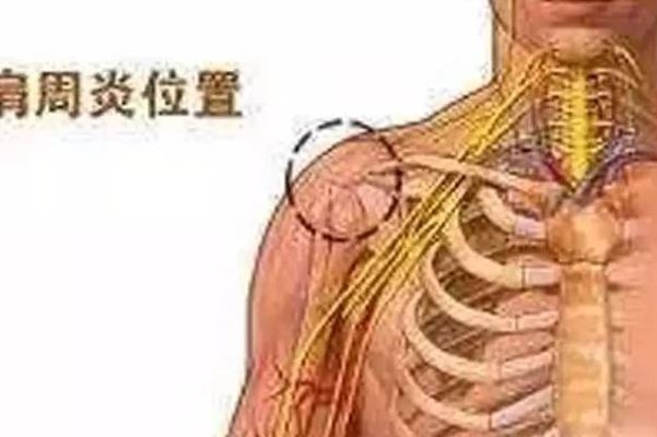 左肩膀痛警惕四种病（左肩膀疼是什么病引起的）