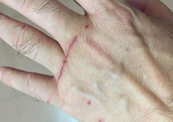 猫抓伤狂犬病几乎为0（猫抓十天后猫没死人用打针吗）