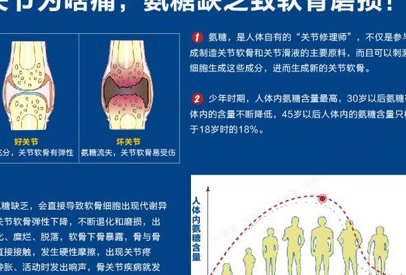 氨糖疗法（氨糖疗法被国际公认是）