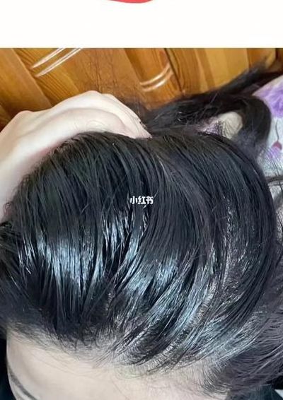 怎么去头油（怎么去头油味最有效）