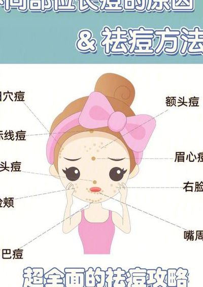 长痘痘的位置图解（长痘痘的位置图解女）