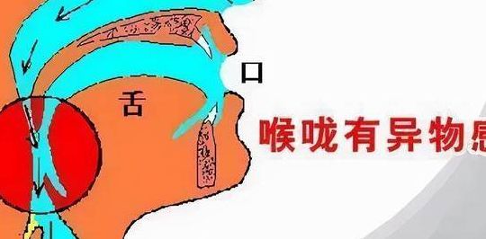 喉咙有异物感是什么原因（喉咙有异物感是什么原因总觉得吞不下去）