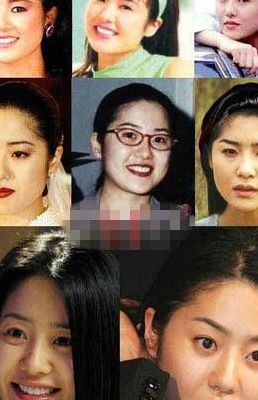 女星整容（女星整容对比照）