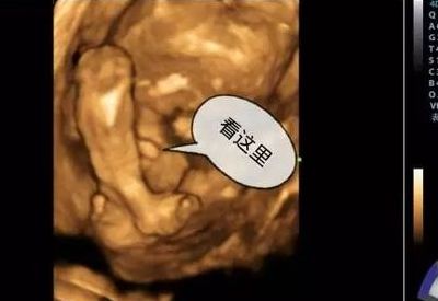 四维彩超数据看性别（四维彩超数据看性别准确吗）