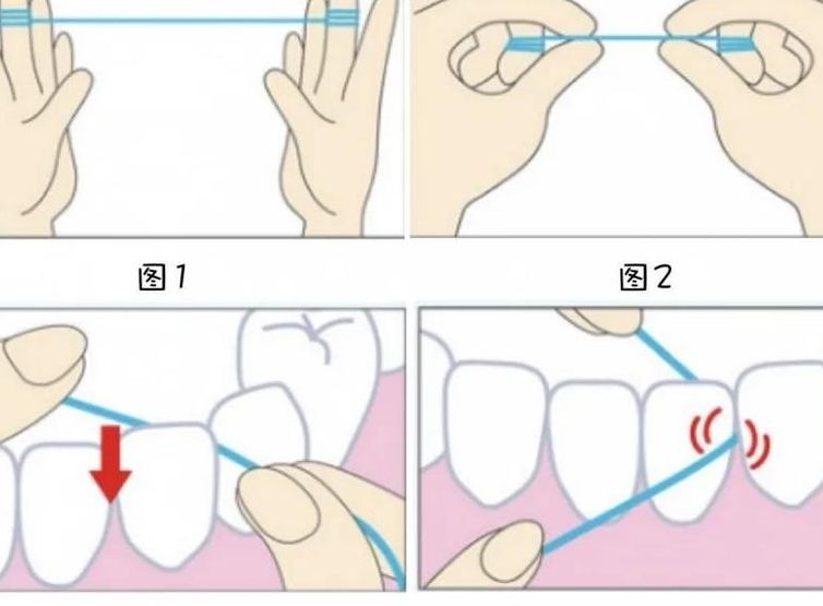 牙线使用方法（牙线使用方法图示）
