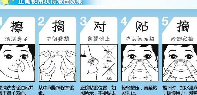 通气鼻贴（通气鼻贴的正确贴法图）