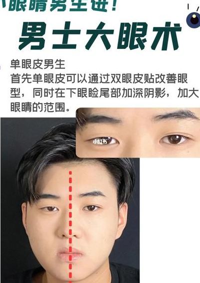 眼睛怎么变大自然方法（男生眼睛小怎么办）