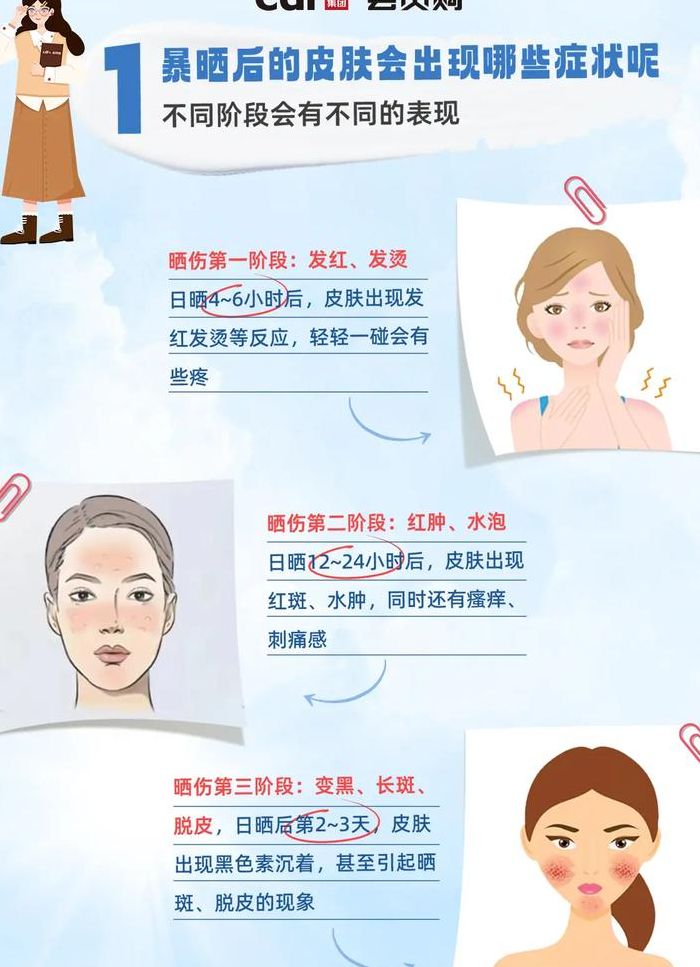 晒后修复怎么用（晒后修复怎么用才正确）