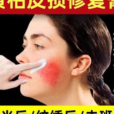 修复脸部角质层（修复脸部角质层用什么好）