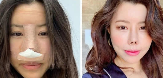 整过容的女明星（整过容的女明星可以拍戏吗）