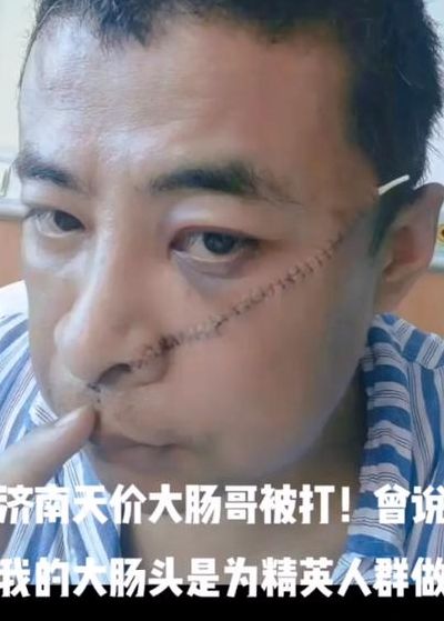 济南大肠头被打（济南名吃大肠）
