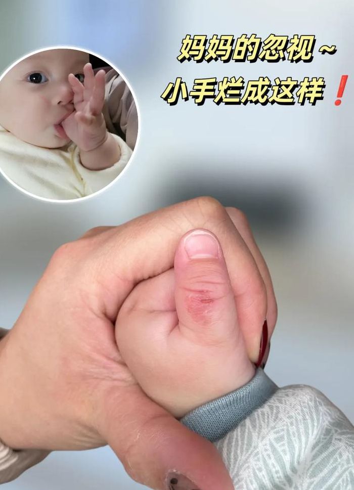 关于宝宝我的手指还在里面的信息