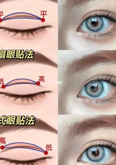 三眼皮怎样贴双眼皮贴（双眼皮贴能把三眼皮贴回双眼皮吗）