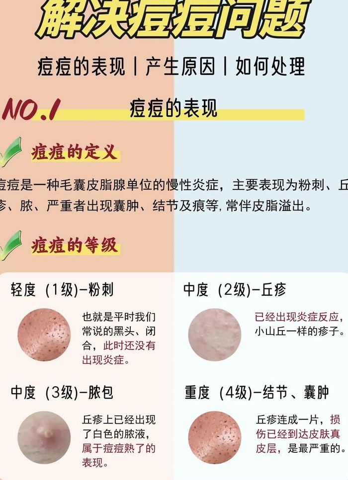 脸上突然爆痘怎么解决（脸上长痘痘怎么才能消除）