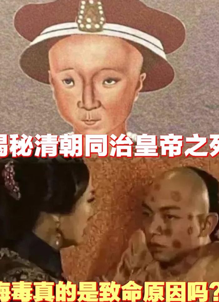 同治怎么死的（同治为什么只活了19岁）