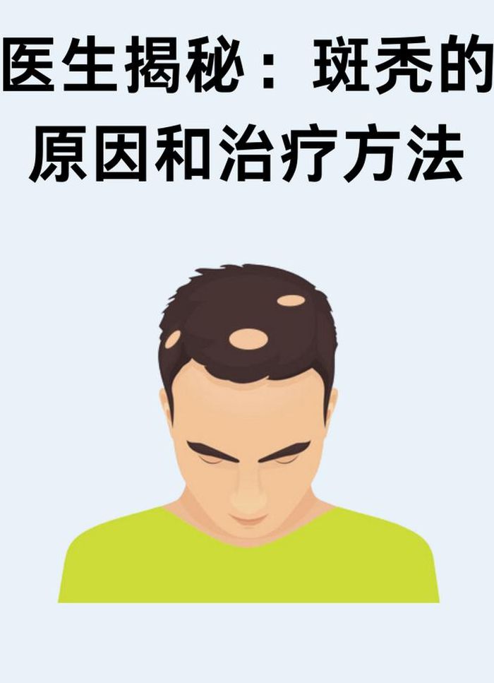 斑秃鬼剃头是什么原因造成的（斑秃真的和鬼有关系吗）