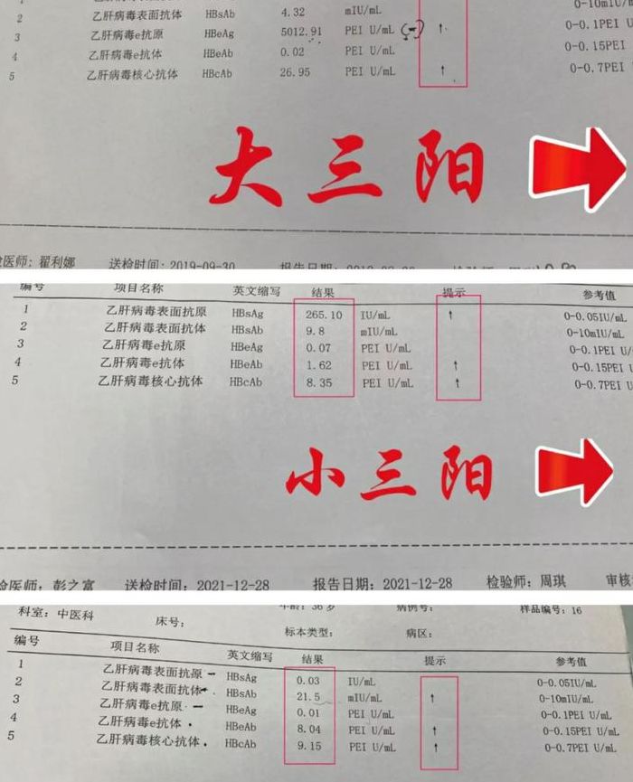 二阳三阳都有什么症状（二三阳严重吗）