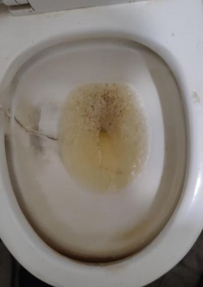 尿液有泡沫是怎么回事（男人尿液有泡沫是怎么回事）