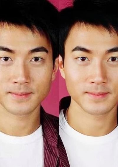刘恺威整容（刘恺威整容前后的照片）