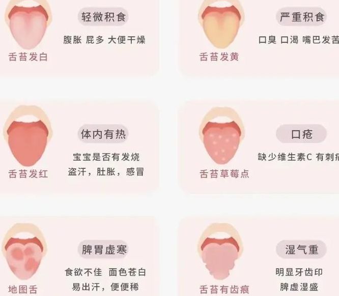 婴儿舌苔厚白是怎么处理（婴儿舌苔厚白怎么调理）