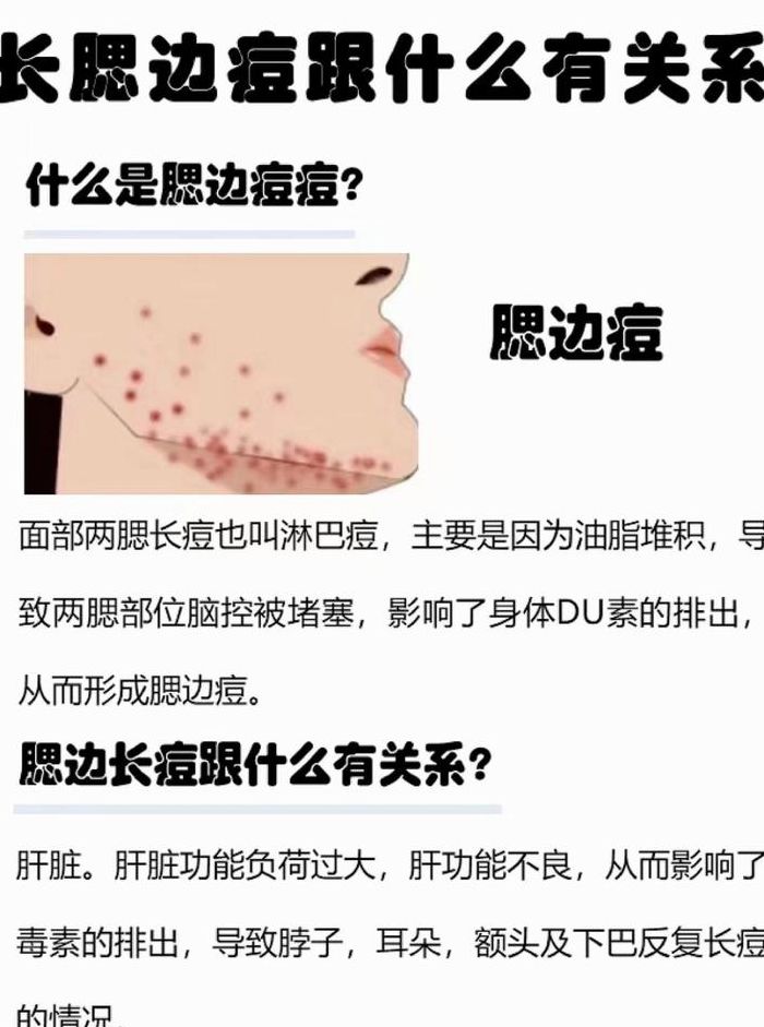 腮边长痘是什么原因（右脸腮边长痘是什么原因）