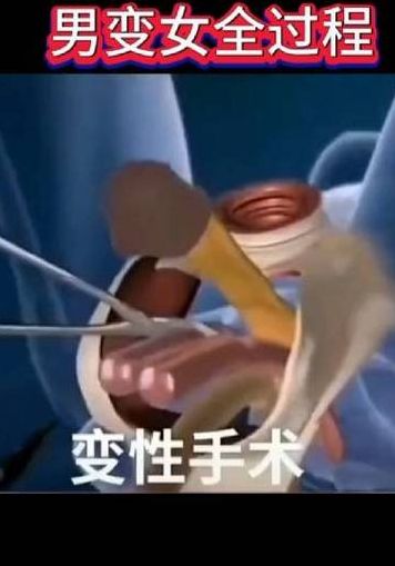 变性是怎样的体验（变性是一种什么样的体验?）