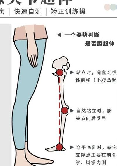 腿变直的方法小窍门（腿变直的小技巧）