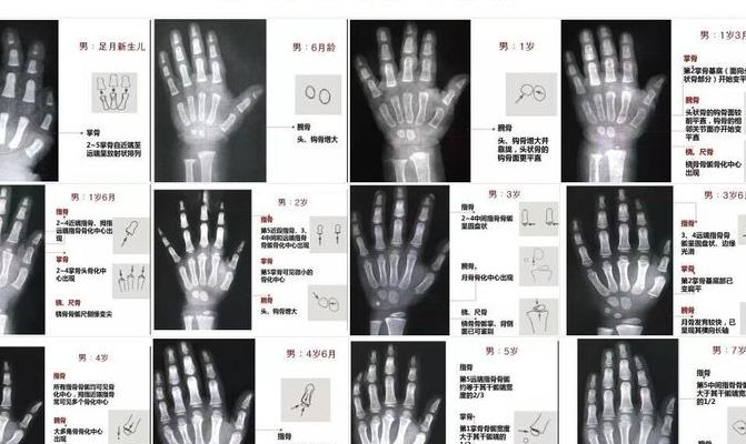 手部骨龄对照表图男生怎么看（手掌骨龄）