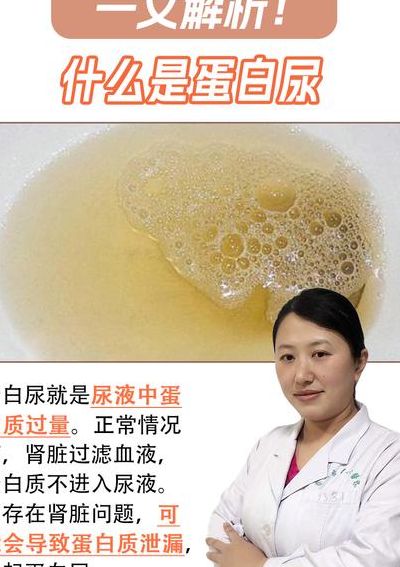 GL是什么意思啊（尿蛋白gl是什么意思啊）