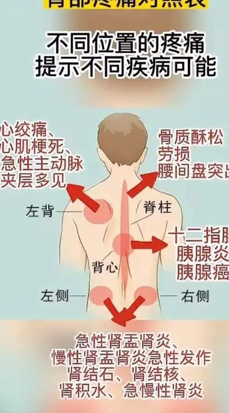 纹身背后疼痛对照表图（纹身后背疼不疼）
