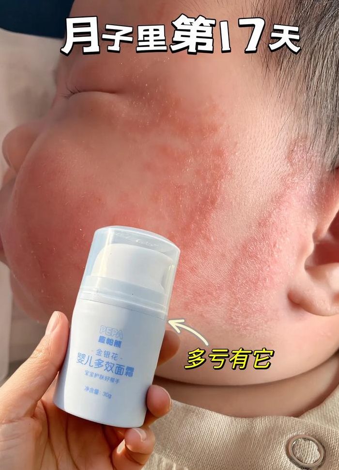 新生儿脸色对照表图（新生儿脸部颜色）